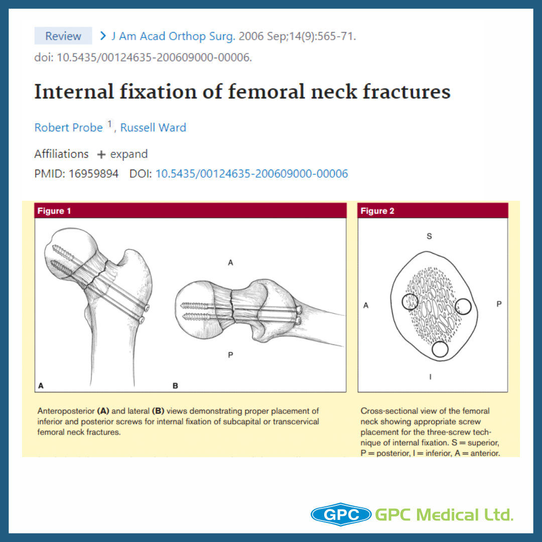 Is double-crossed retrograde elastic stable intramedullary nailing an  alternative method for the treatment of diaphyseal fractures in the adult  humerus? | Journal of Orthopaedics and Traumatology | Full Text